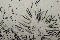 Biscogniauxia nummularia