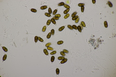Truncatella conorum-piceae