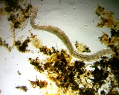 Aeolosoma
