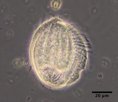 Phacodinium