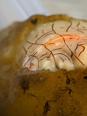 Eurylepta californica
