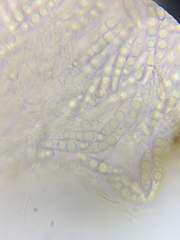 Lophiostoma