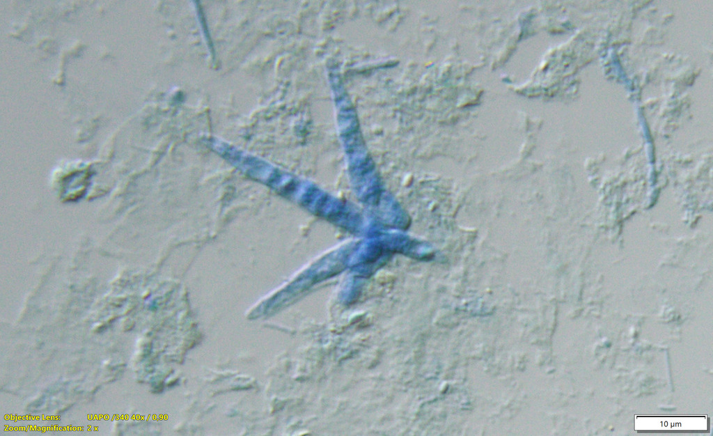 Tulipispora