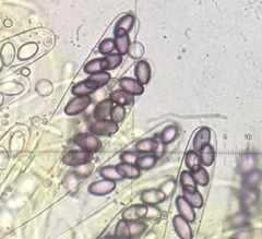 Ascobolus crenulatus