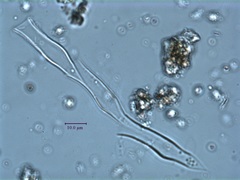 Dinobryon cylindricum