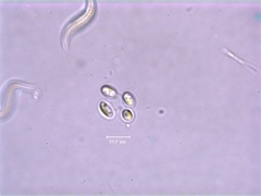 Dictyosphaerium