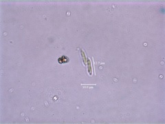 Quadrigula