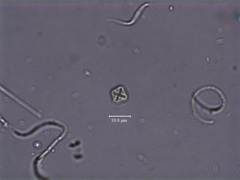 Lemmermannia tetrapedia