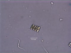 Scenedesmus quadricauda