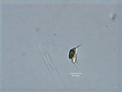 Scenedesmus quadricauda