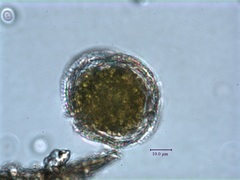 Peridinium gatunense