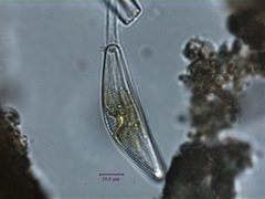 Cymbella
