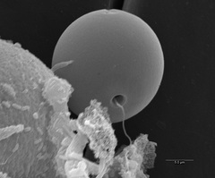 Trachelomonas volvocina