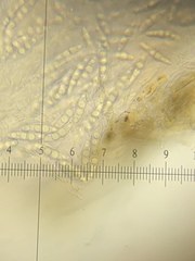 Lophiostoma