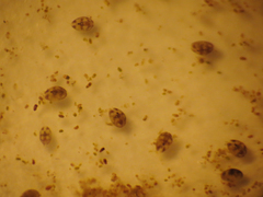 Ostracoda