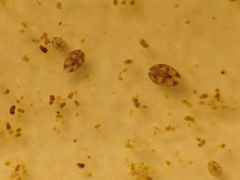Ostracoda