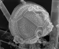 Peridinium gatunense