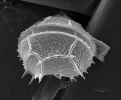 Peridiniopsis elpatiewskyi