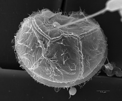 Thompsodinium intermedium