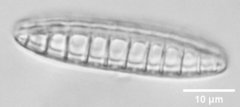 Denticula