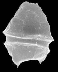 Parvodinium umbonatum