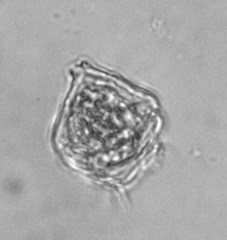 Peridiniopsis quadridens