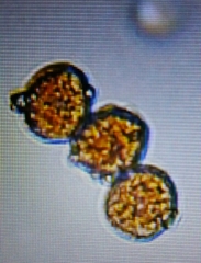 Puccinia lagenophorae