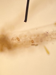 Cocconeis