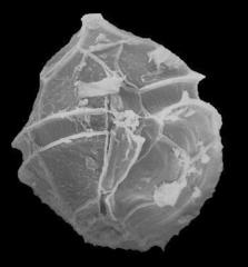 Thompsodinium intermedium