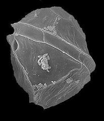 Thompsodinium intermedium