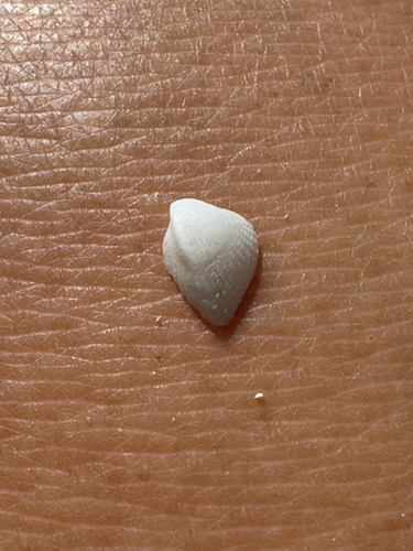 Fragum mundum observed 2026-05-03