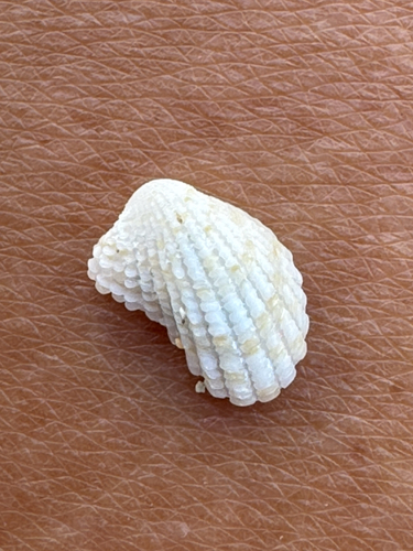 Cardita observed 2026-05-03