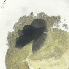 Pilobolus crystallinus