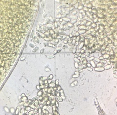 Pilobolus crystallinus