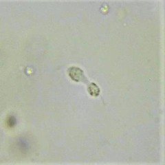 Spumella