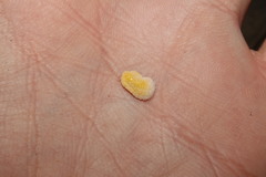 Marchalina hellenica