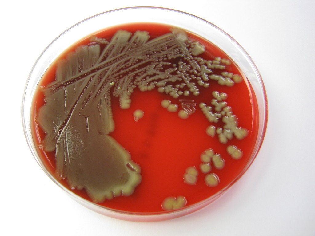 Cronobacter