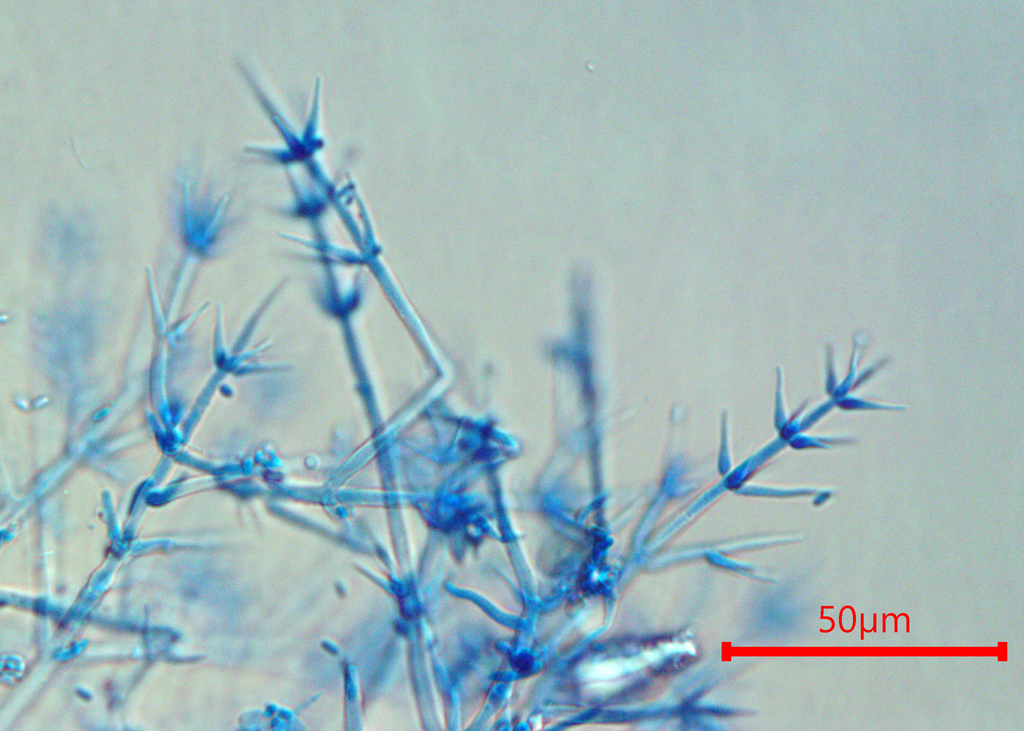 Calcarisporium
