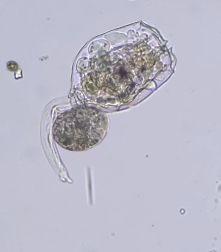 Brachionus angularis