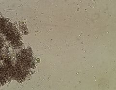 Phylloblastia fortuita