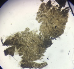 Podospora appendiculata