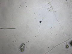 Acaulopage acanthospora