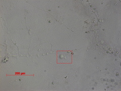 Acaulopage acanthospora