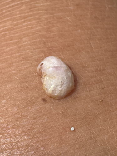 Bostrycapulus calyptraeiformis