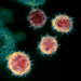 Severe acute respiratory syndrome-related coronavirus - Photo (c) 
NIAID,  זכויות יוצרים חלקיות (CC BY)