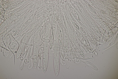 Lophodermium pini-excelsae