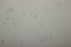 Ramularia cylindroides