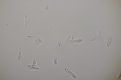 Ramularia cylindroides