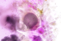 Synchytrium anemones