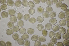 Pucciniastrum areolatum